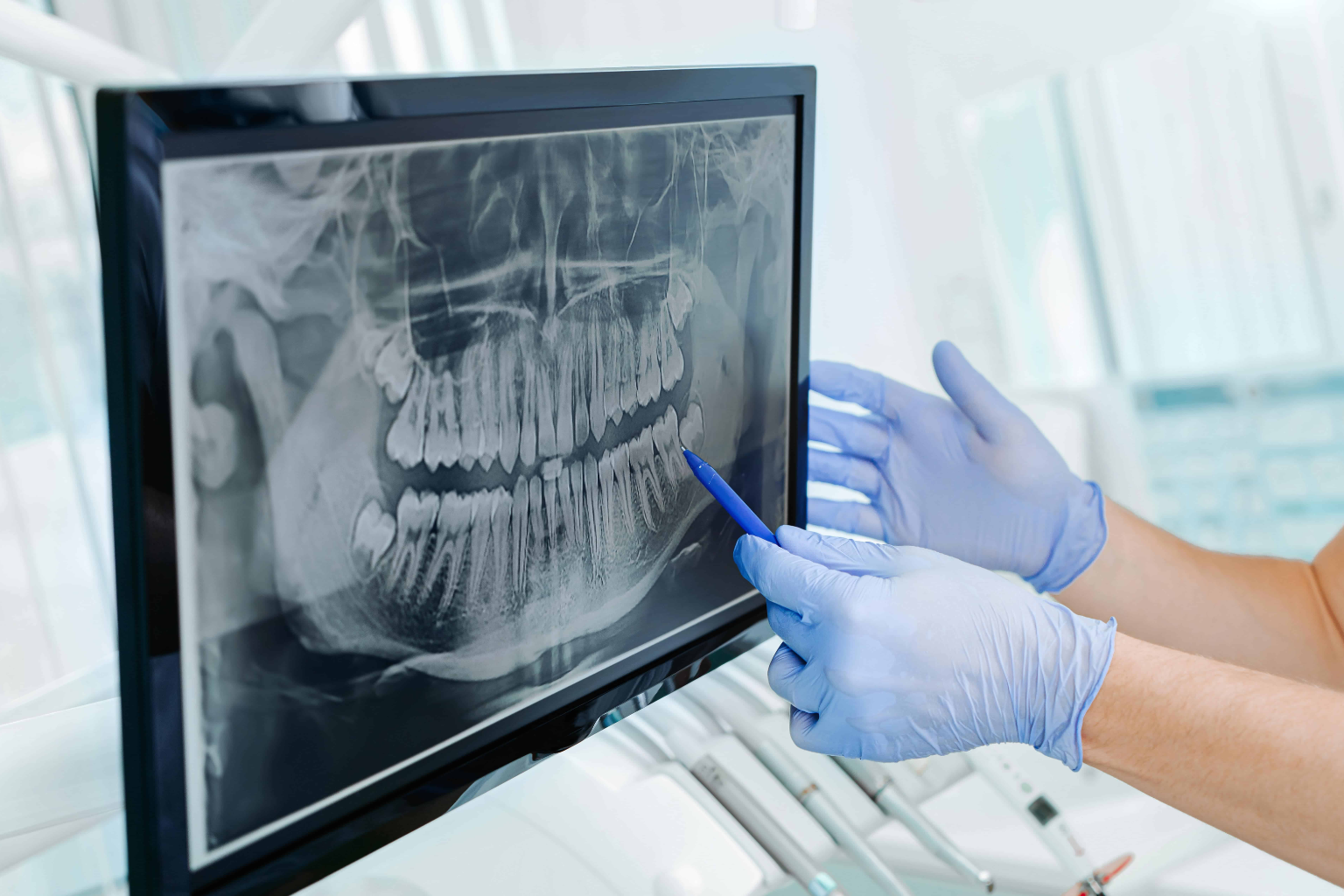 digital radiography